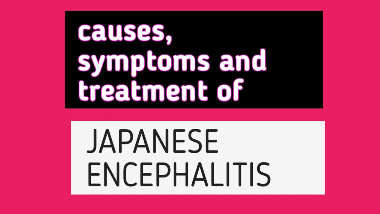 Encephalitis Japanese